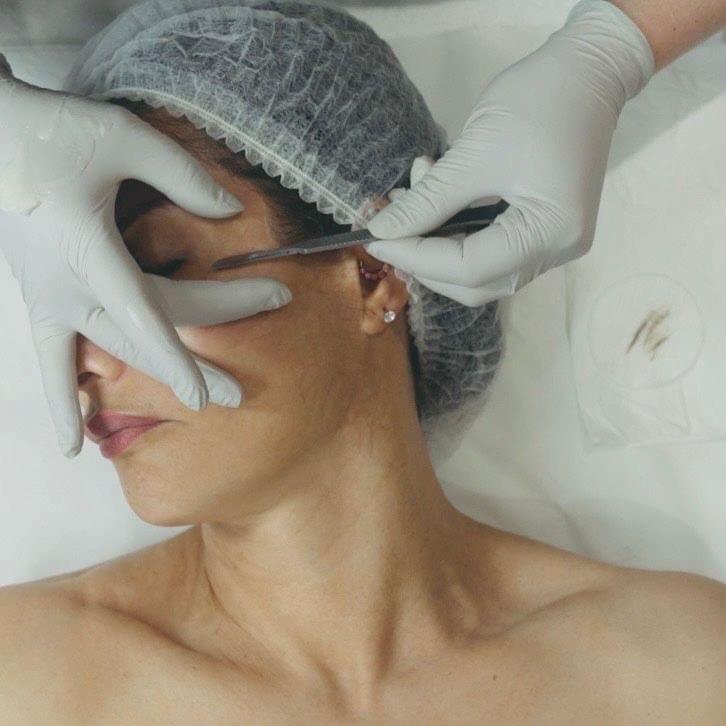 Realizando una sesión de dermaplaning coreano