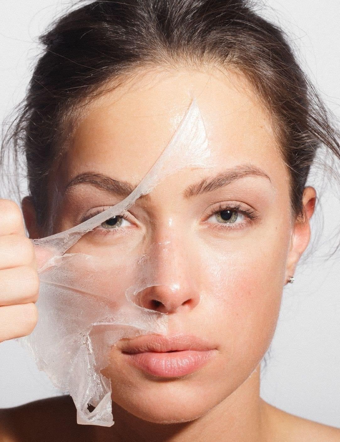 Chica mosotrando su cara después de realizarse un tratamiento k-peeling